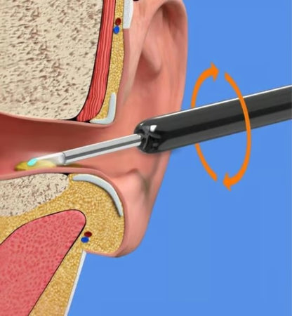 Wireless WIFI Visual Ear Pick